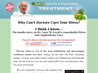 Natural Urticaria (Hives) & Angioedema Treatment By Dr. Gary M Levin
